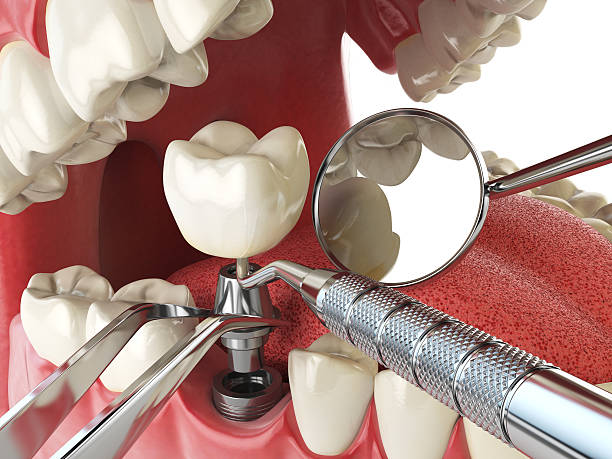 Best Tooth Pain Emergency Relief  in Dallas, GA